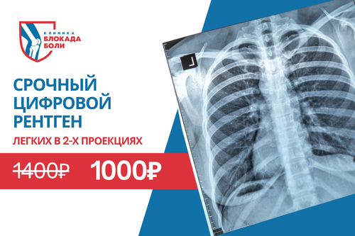 Акция "Срочный цифровой рентген легких - недорого и точно - клиника Блокада Боли Челябинск"